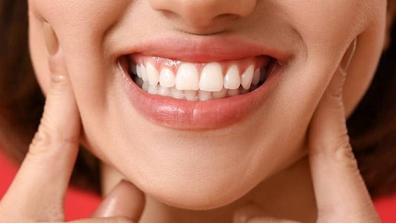 Best dental clinic Ang Mo Kio